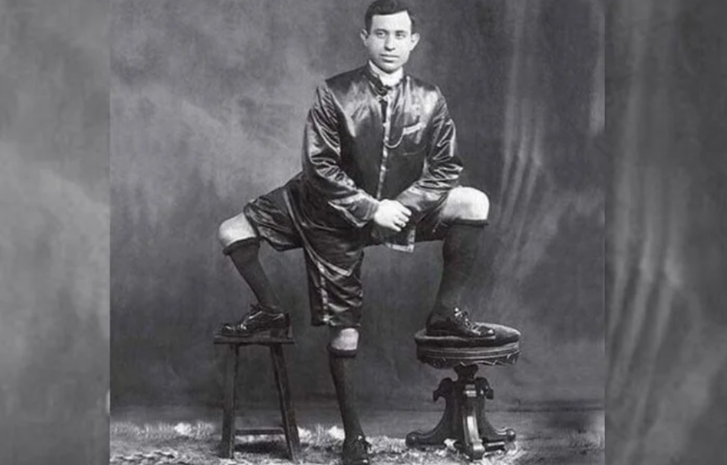 Frankie Five Legs: The Mobster You Never Saw Coming